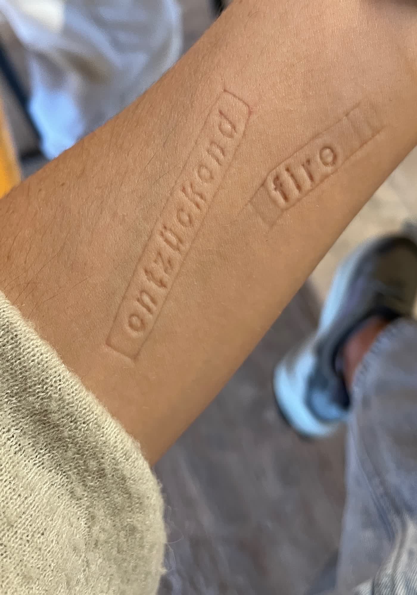 Schlagende Komplimente